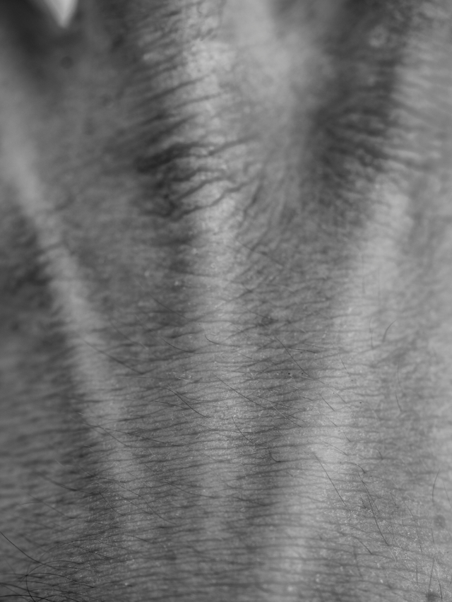 3-POSTING—handchirurgie-01